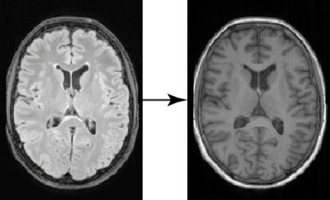 FLAIR到T1w转换