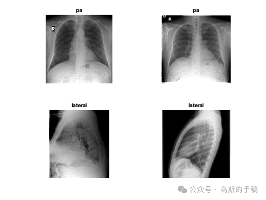 深度学习故障诊断规则提取案例分析（可解释性）-AI.x社区